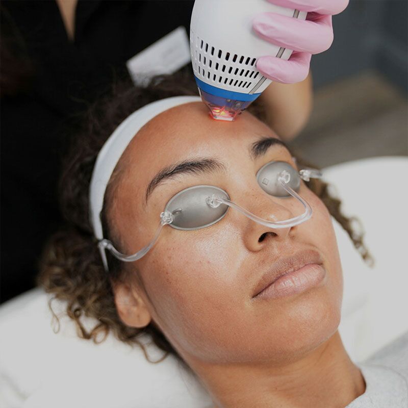 Refine RX Facials: Buy 3, get the 4th free