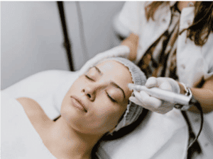 Woman laying down with eyes closed receiving a microneedling skincare treatment from a skincare professional